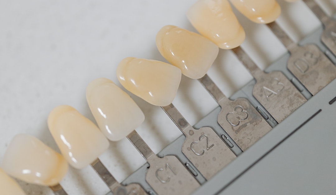 Options for Replacing a Missing Tooth