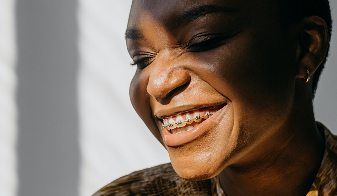 Common Myths About Cosmetic Dentistry