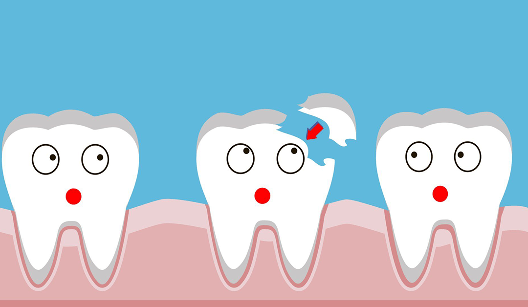 Cracked/Broken Teeth: Causes, Symptoms, Treatment, and Prevention